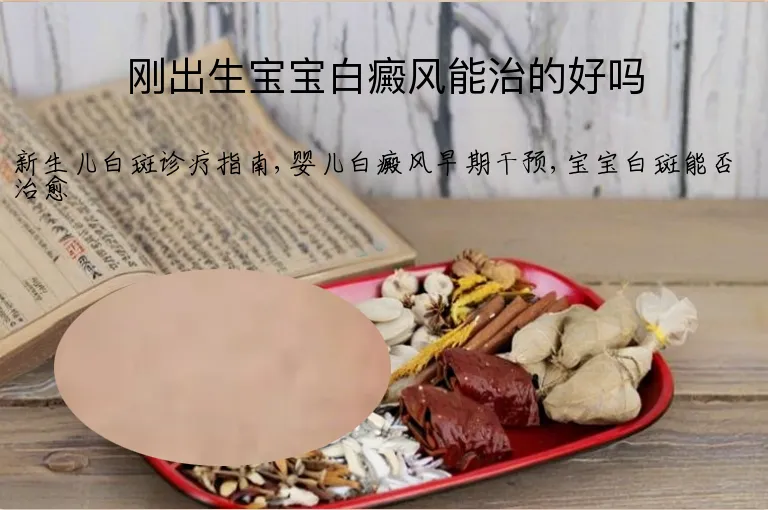 刚出生宝宝白癜风能治的好吗