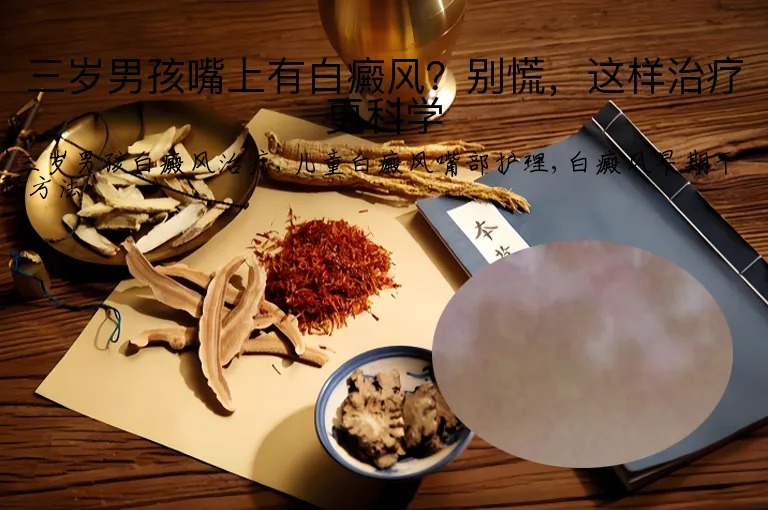 三岁男孩嘴上有白癜风？别慌，这样治疗更科学