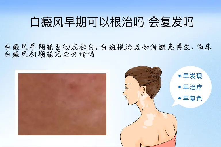 白癜风早期可以根治吗 会复发吗