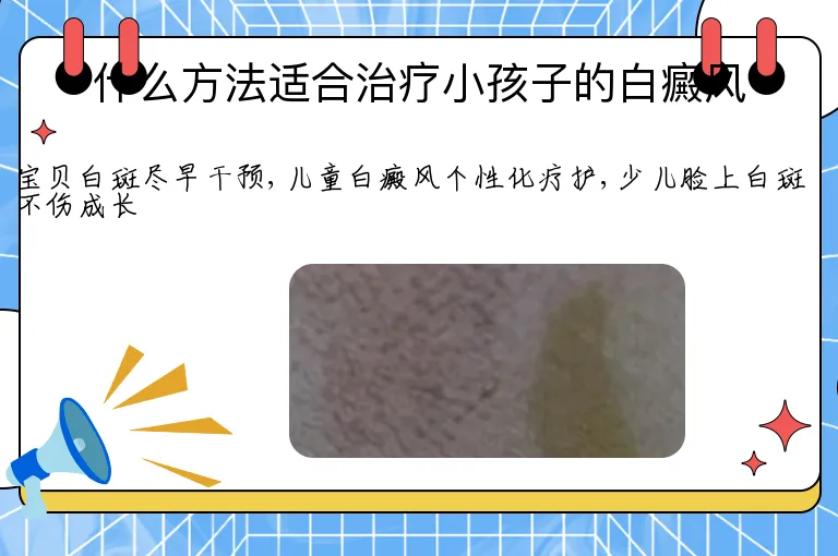 什么方法适合治疗小孩子的白癜风