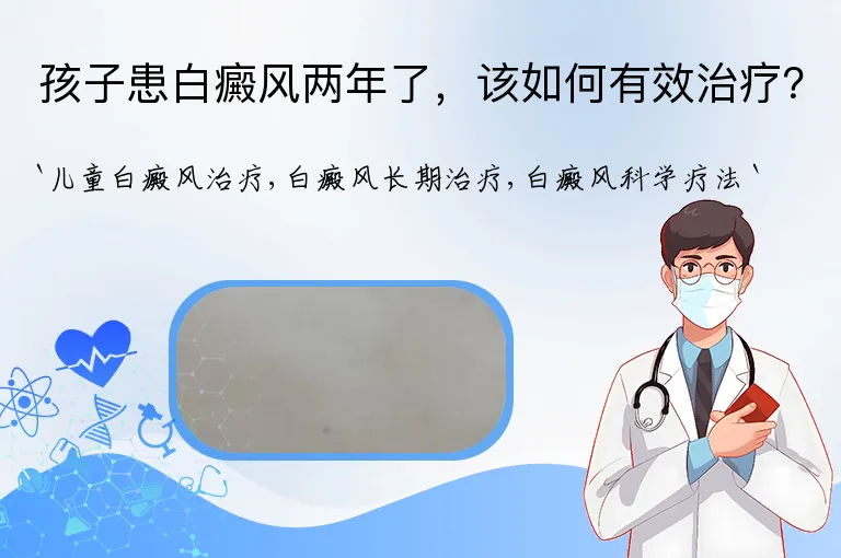 孩子患白癜风两年了，该如何有效治疗？