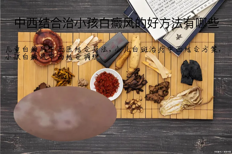 中西结合治小孩白癜风的好方法有哪些