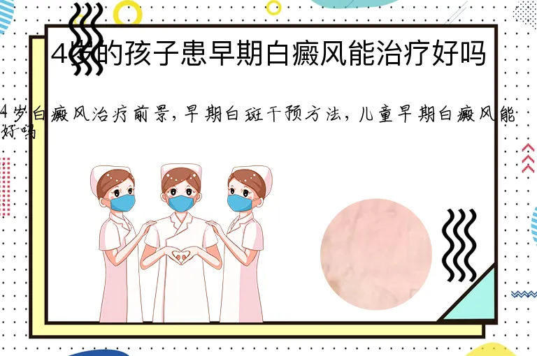 4岁的孩子患早期白癜风能治疗好吗
