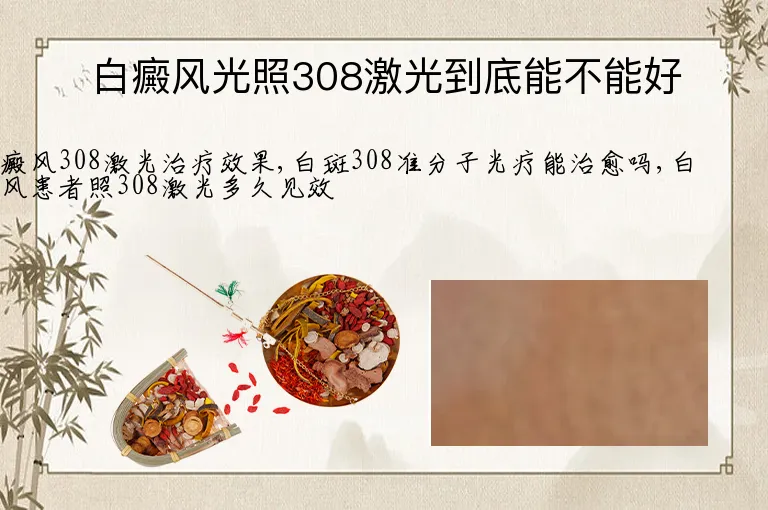 白癜风光照308激光到底能不能好