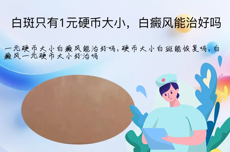 白斑只有1元硬币大小,白癜风能治好吗