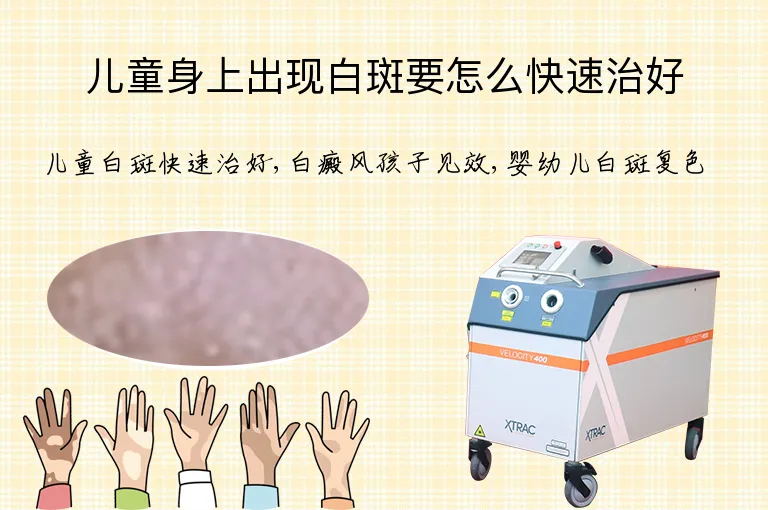 儿童身上出现白斑要怎么快速治好