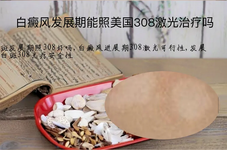 白癜风发展期能照美国308激光治疗吗