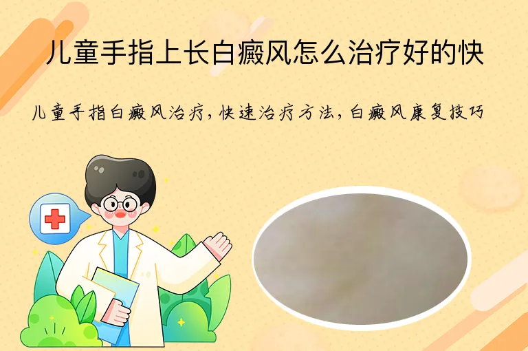 儿童手指上长白癜风怎么治疗好的快