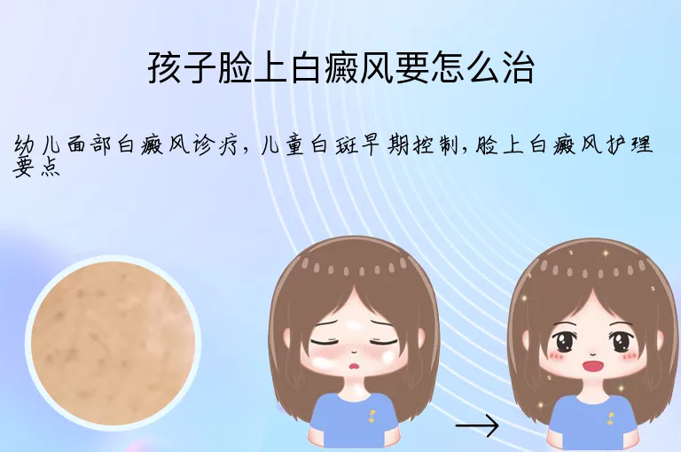 孩子脸上白癜风要怎么治
