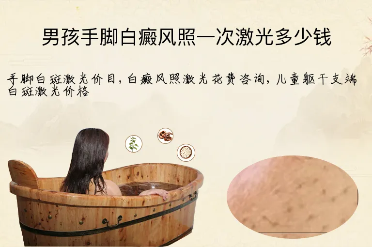 男孩手脚白癜风照一次激光多少钱
