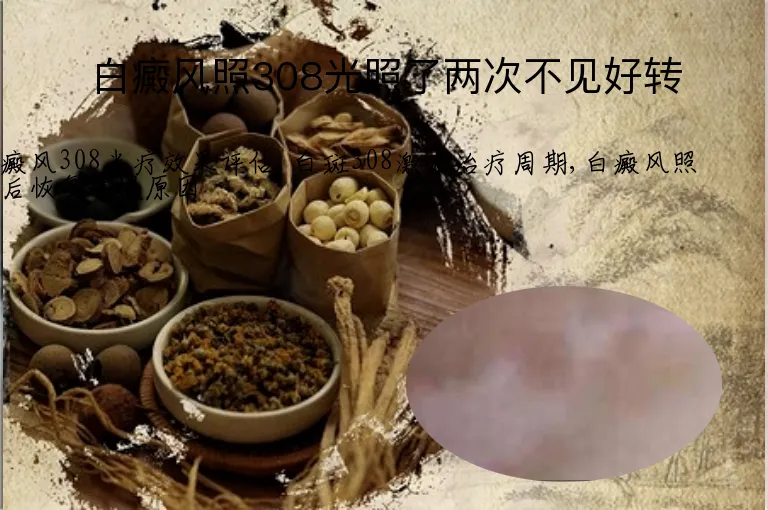 白癜风照308光照了两次不见好转