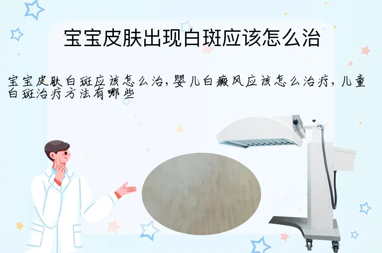 宝宝皮肤出现白斑应该怎么治