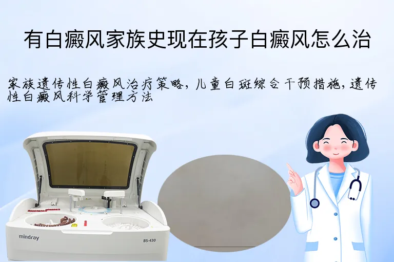 有白癜风家族史现在孩子白癜风怎么治