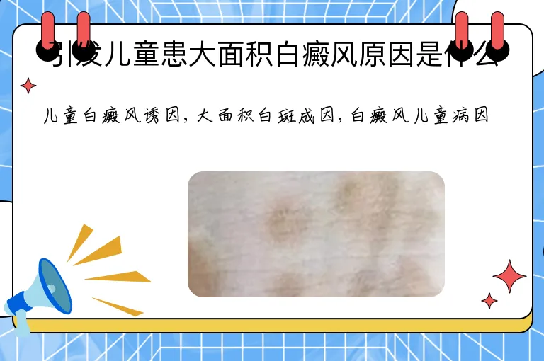 引发儿童患大面积白癜风原因是什么