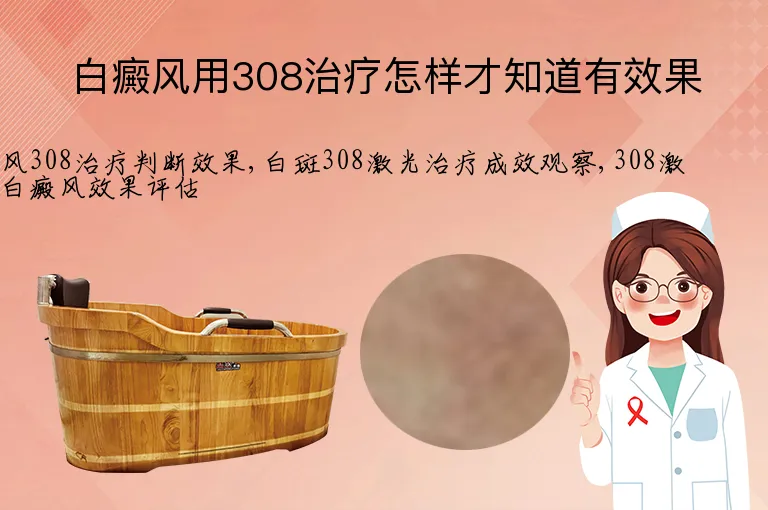 白癜风用308治疗怎样才知道有效果