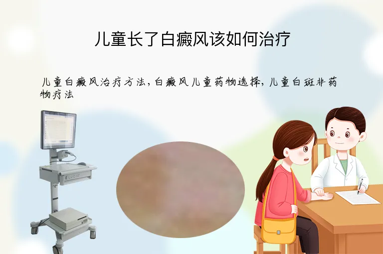 儿童长了白癜风该如何治疗