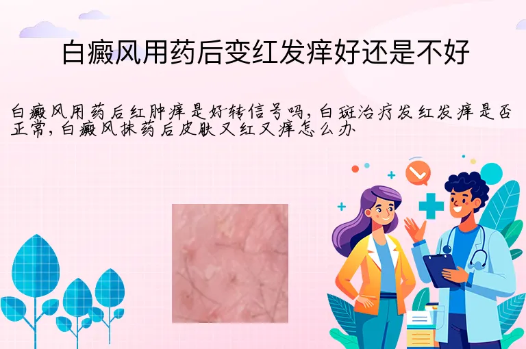 白癜风用药后变红发痒好还是不好