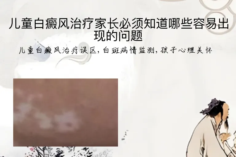 儿童白癜风治疗家长必须知道哪些容易出现的问题