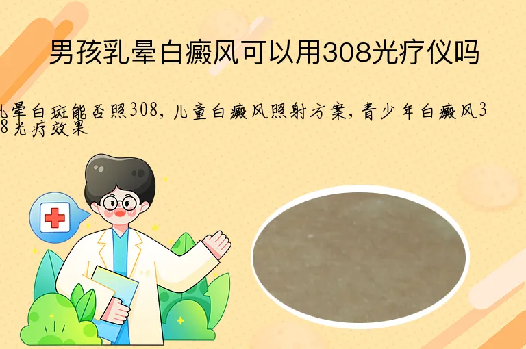 男孩乳晕白癜风可以用308光疗仪吗