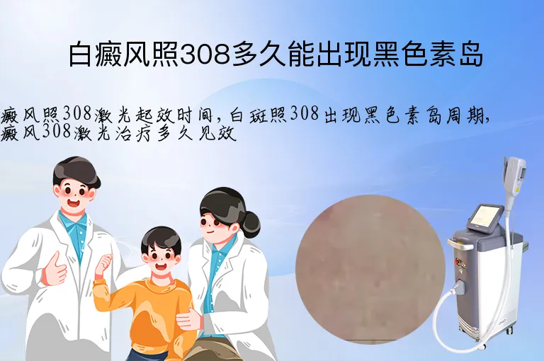 白癜风照308多久能出现黑色素岛