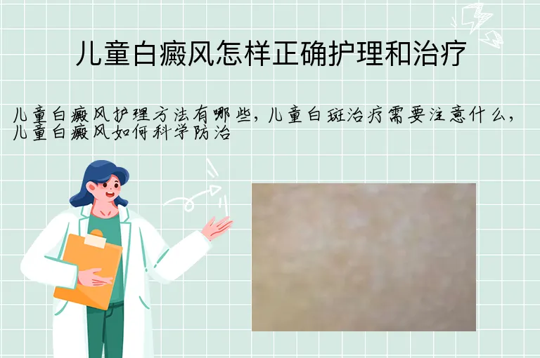 儿童白癜风怎样正确护理和治疗