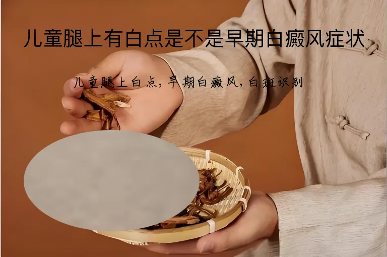 儿童腿上有白点是不是早期白癜风症状