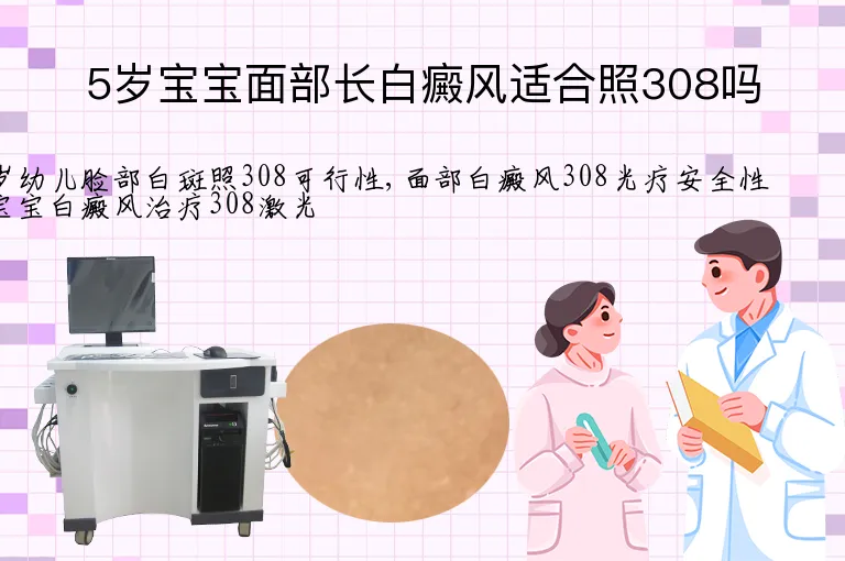 5岁宝宝面部长白癜风适合照308吗