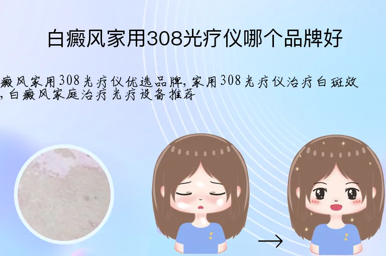 白癜风家用308光疗仪哪个品牌好