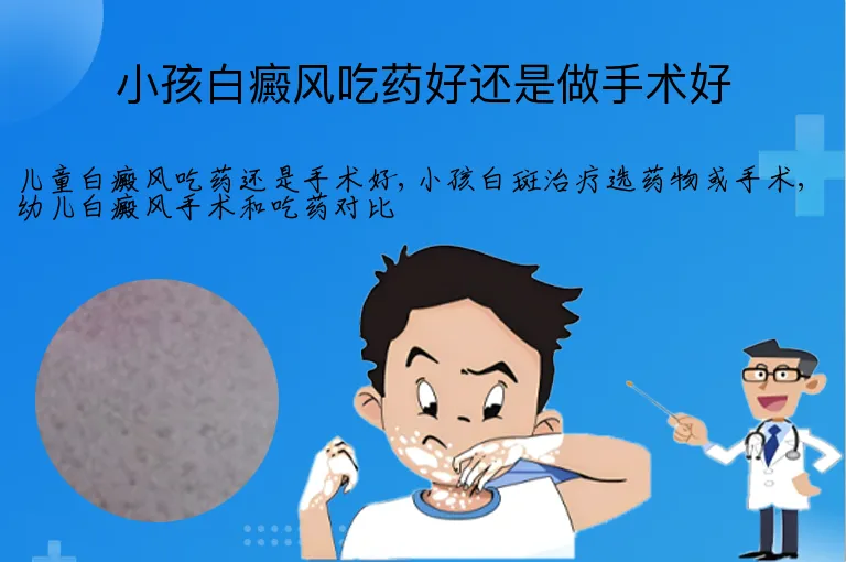小孩白癜风吃药好还是做手术好