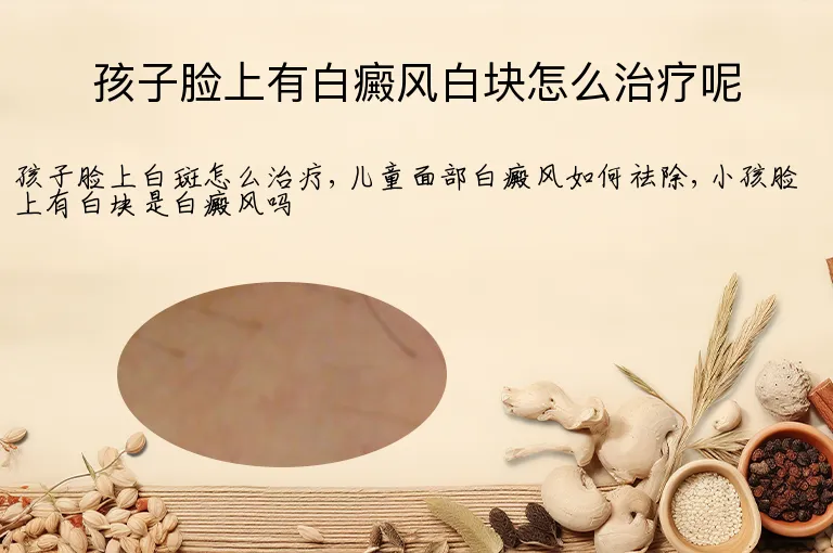 孩子脸上有白癜风白块怎么治疗呢