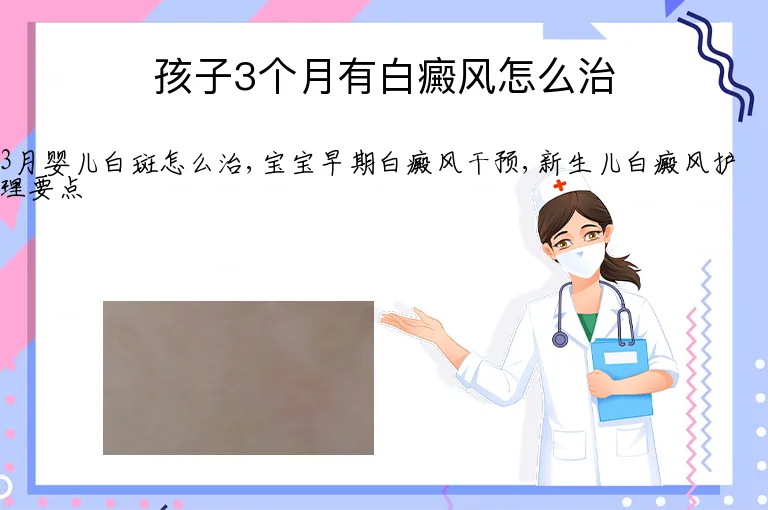 孩子3个月有白癜风怎么治