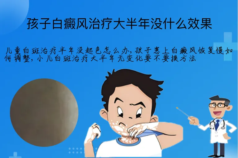 孩子白癜风治疗大半年没什么效果
