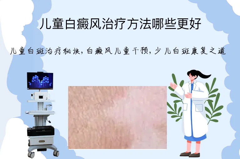 儿童白癜风治疗方法哪些更好