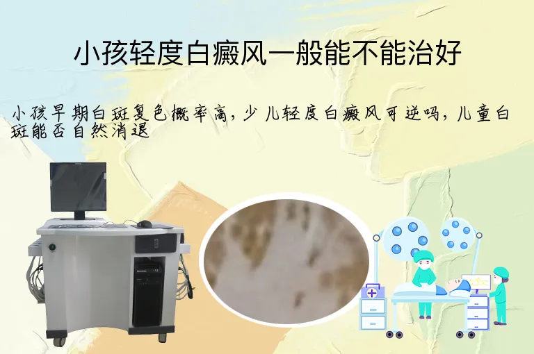 小孩轻度白癜风一般能不能治好