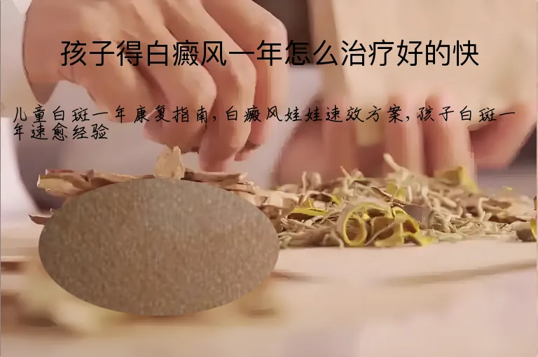 孩子得白癜风一年怎么治疗好的快