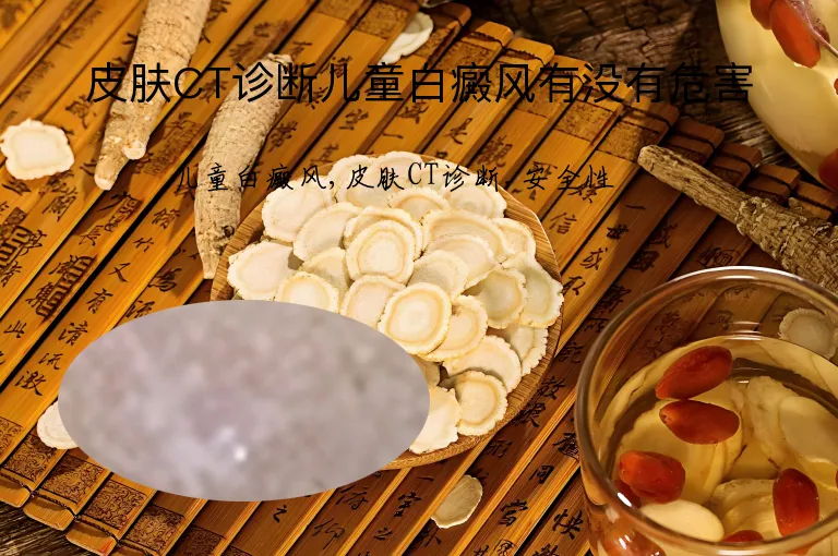 皮肤CT诊断儿童白癜风有没有危害