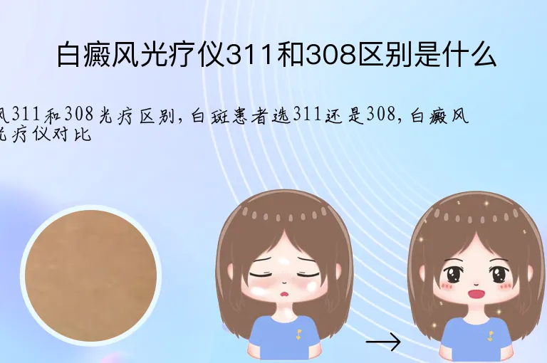 白癜风光疗仪311和308区别是什么
