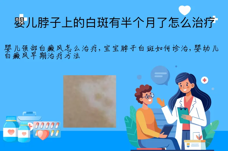 婴儿脖子上的白斑有半个月了怎么治疗