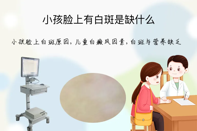 小孩脸上有白斑是缺什么