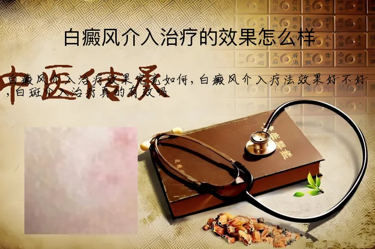 白癜风介入治疗的效果怎么样
