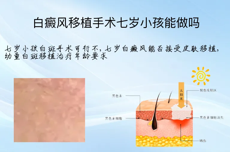 白癜风移植手术七岁小孩能做吗