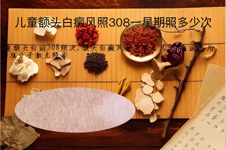 儿童额头白癜风照308一星期照多少次