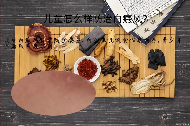 儿童怎么样防治白癜风？
