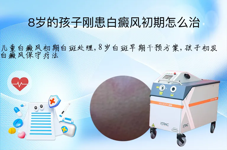 8岁的孩子刚患白癜风初期怎么治