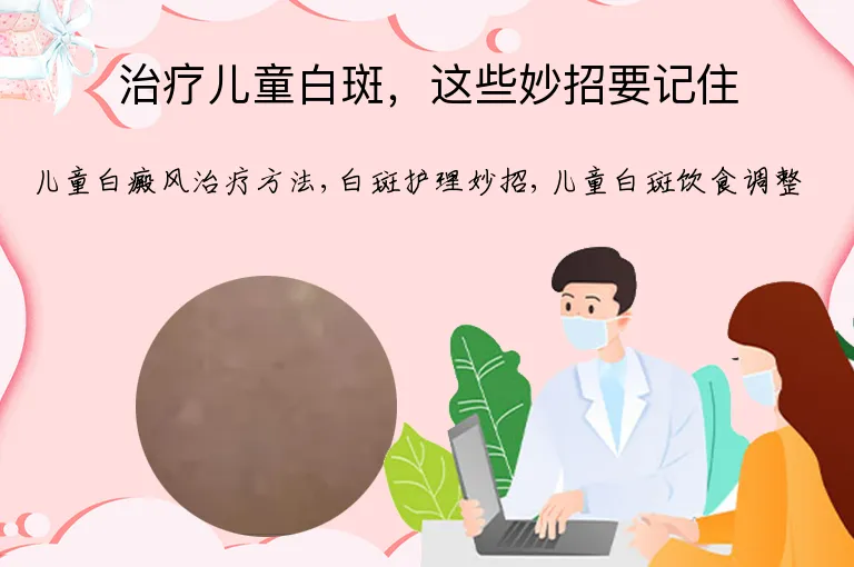 治疗儿童白斑，这些妙招要记住