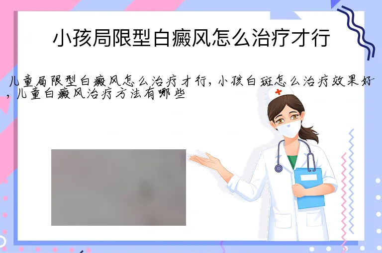 小孩局限型白癜风怎么治疗才行