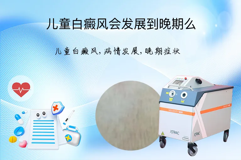 儿童白癜风会发展到晚期么