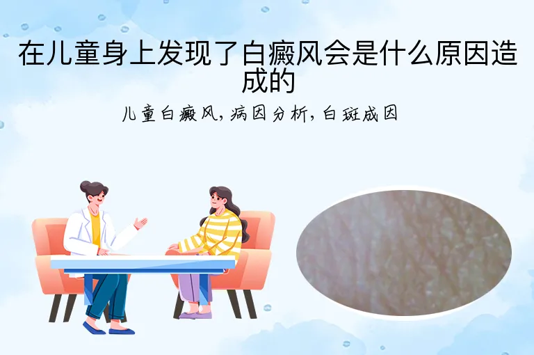 在儿童身上发现了白癜风会是什么原因造成的