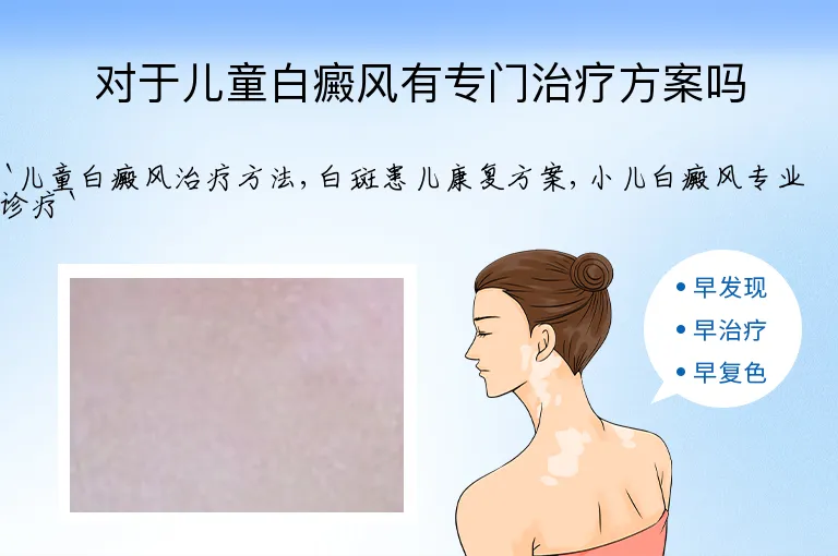 对于儿童白癜风有专门治疗方案吗