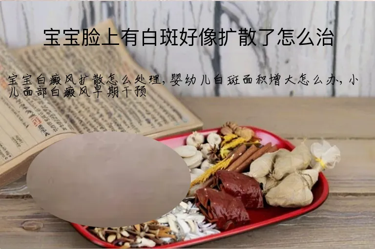 宝宝脸上有白斑好像扩散了怎么治